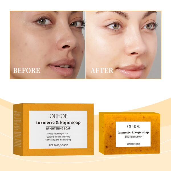 Lemon Turmeric Brightening Soap Gently Cleanses The Skin, Moisturizes, Hydrates And Replenishes Water. It Is A Facial And Body Care Soap - Image 2