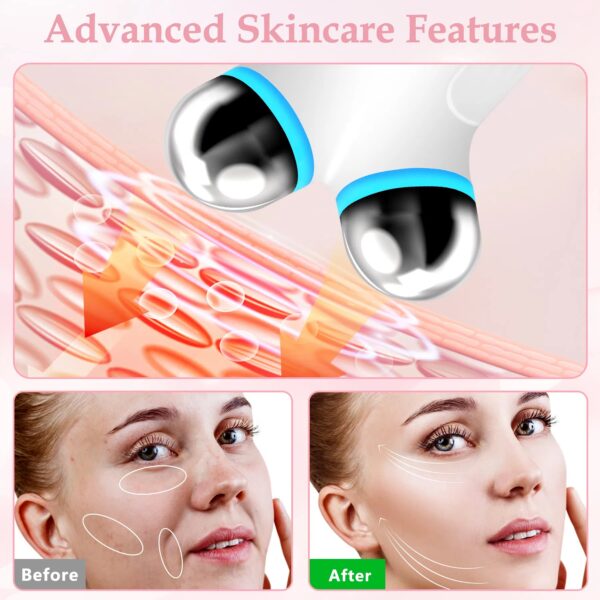 Anti Aging And Wrinkles Microcurrent Facial Device, Boost Skin Care Products Absorption - White - Image 2