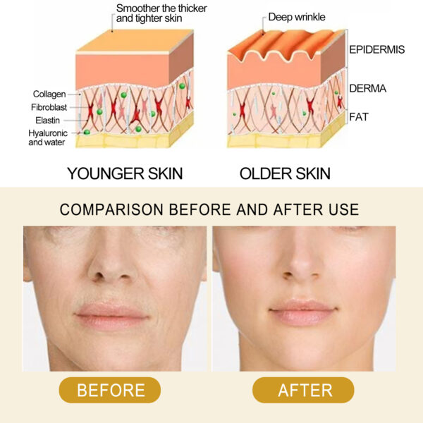 EELHOE Collagen Essence Improves Facial Skin, Lightens Fine Lines, Hydrates And Firms The Skin - Image 2
