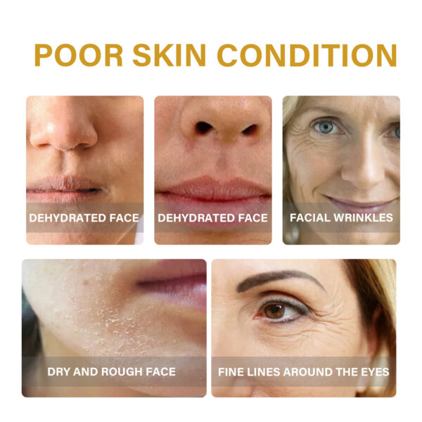 EELHOE Collagen Essence Improves Facial Skin, Lightens Fine Lines, Hydrates And Firms The Skin - Image 4